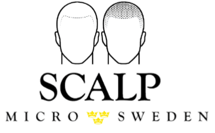 Scalp Micro Sweden | Scalp Micropigmentation Stockholm | Utbildning
