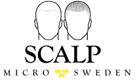 Scalp Micro Sweden | Scalp Micropigmentation Stockholm | Utbildning