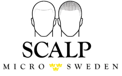 Scalp Micro Sweden | Scalp Micropigmentation Stockholm | Utbildning